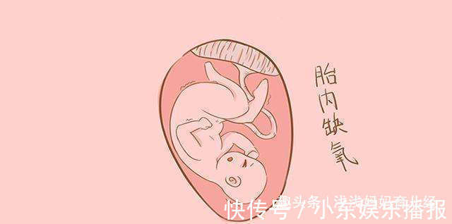 紧身裤|胎儿缺氧,释放4种信号!预防缺氧,孕妈妈最好杜绝9种常见行为