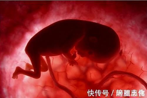 受精卵|首例试管婴儿已经32岁了!情况可能和你们想的不一样