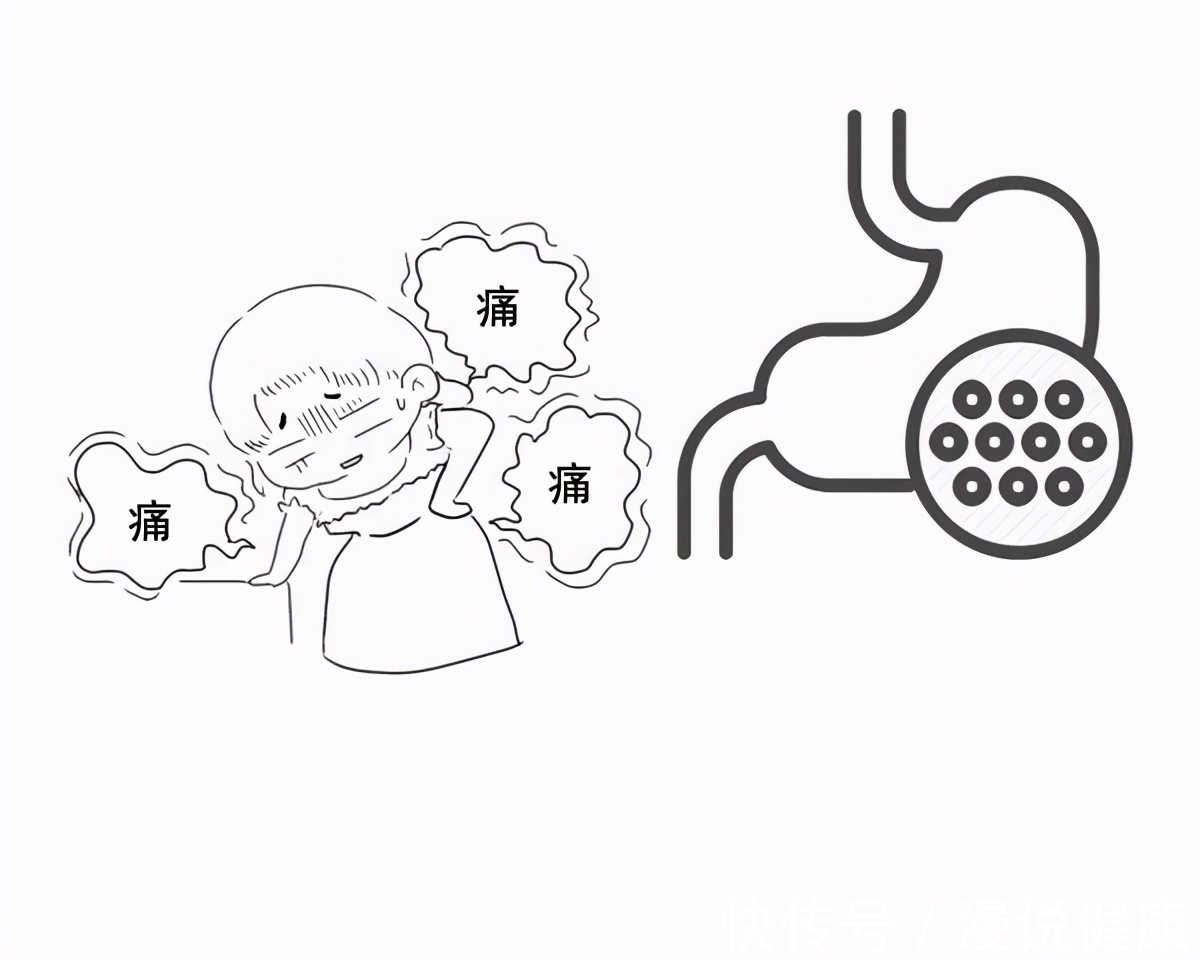 幽门螺旋杆菌|一人感染，全家牵连？超过一半的国人感染的细菌，我们该如何预防