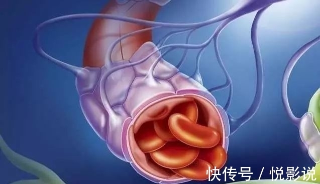 自救|发现自己血脂高怎么办?医生:4个方法可自救 ,早知道早好