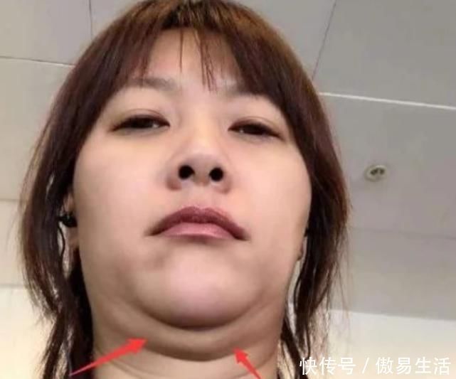 女生脸部“尺寸”越来越大多半有这3习惯,难怪你是大脸盘子