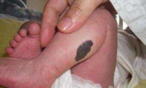 坏习惯|怀孕后，孕妈常有这3个“坏习惯”，宝宝易长胎记，一定要多留心