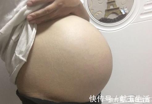 心眼|脐带绕颈一周，可能有这些影响，准妈妈要多留心眼