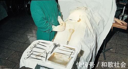 子宫|剖腹产只是“挨一刀”就完事?看完手术全过程,忍不住心疼女人