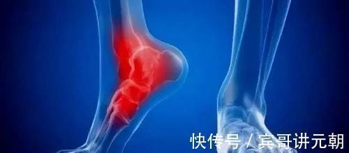 诱发|40岁后容易出现足跟痛,多是3种原因造成的,早点知道比较好