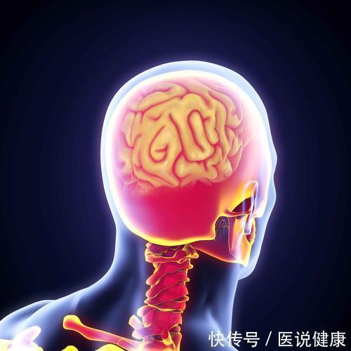 脑血管堵塞|头部出现4个表现,或是脑部血管出问题了,发现后,及时检查