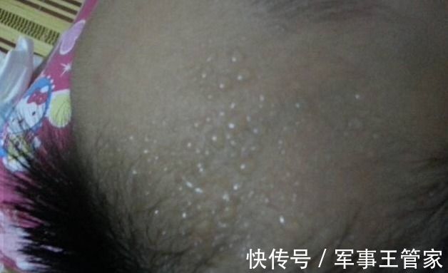 兴奋|宝宝睡觉时头上有“汗珠”，只是因为“缺钙”吗？家长需了解真相