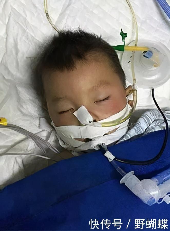 后脑勺|母亲一巴掌,小儿子口吐白沫,专家提醒:孩子有4处不能打