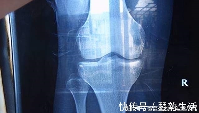 长高|家长矮孩子就一定矮吗？抓住三个“猛涨期”，想有个大高个不是梦