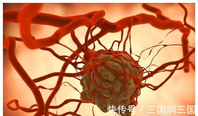 癌症患者|肿瘤专家揭秘:癌症患者永远不明白的4个真相
