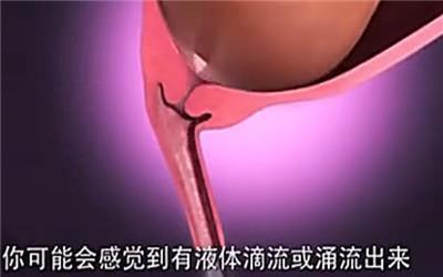 胎头那么大,到底是怎样从那么小的口出来顺产分娩全过程-附图