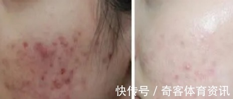 氨基酸洗面奶 便宜却好用的护肤品,这5款才是“万年青”,火了多年还很流行!