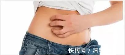 痒痛失三胞胎|31周孕妈忍痒痛失三胞胎:孕期不是所有不适都该忍