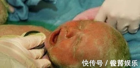 剖腹产|22岁孕妇痛了1天2夜,丈夫不愿剖腹产,孩子出生产妇决定离婚