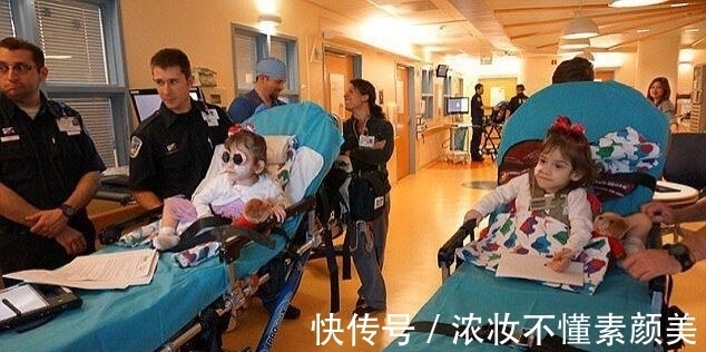 双胞胎|连体双胞胎做分离手术成功,每人分得一条腿,父母喜极而泣!