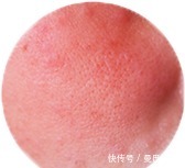 小白必看の护肤步骤