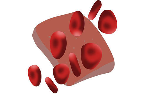 高血脂|54岁时查出高血脂,之后每天日行万步,坚持了18年,他怎样了?