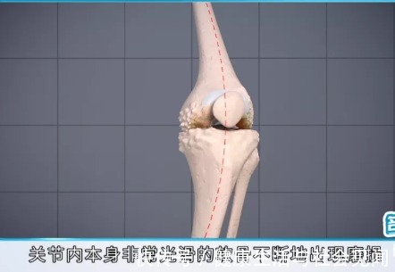 要点|全膝关节置换靠谱不？能用多长时间？祥和骨外科专家为你剖析