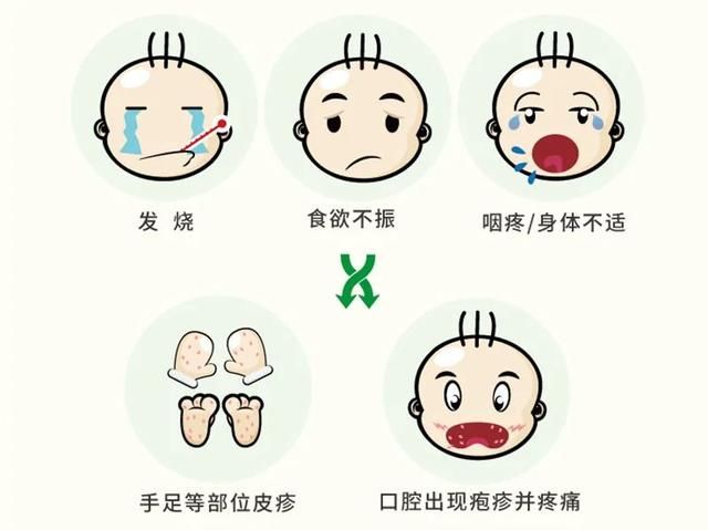 防护|手足口病高发期！做好这些事情，让孩子的防护力加倍