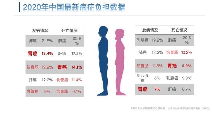 早筛|我国胃癌的5年生存率远低于日韩背后：早筛早诊缺乏，一次舒适化胃镜筛查一个生死决定