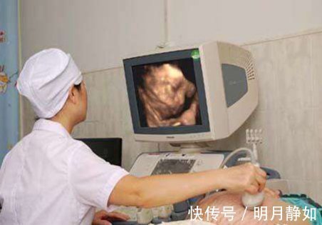 产检|孕妇做四维彩超时不能有家属陪同了解原因后,要充分配合医生