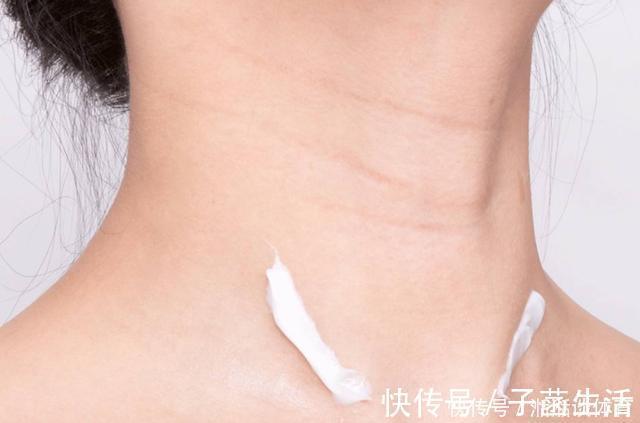 肌肤|无论男女，脖子上出现这种“问题”，别大意！赶紧采取措施
