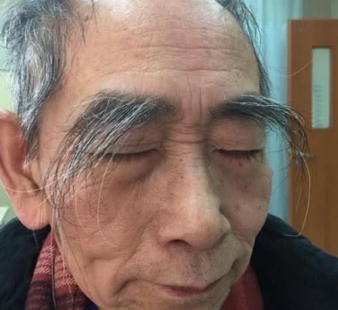 医生|不论男女，眉毛变长，意味着什么呢？听听医生怎么说