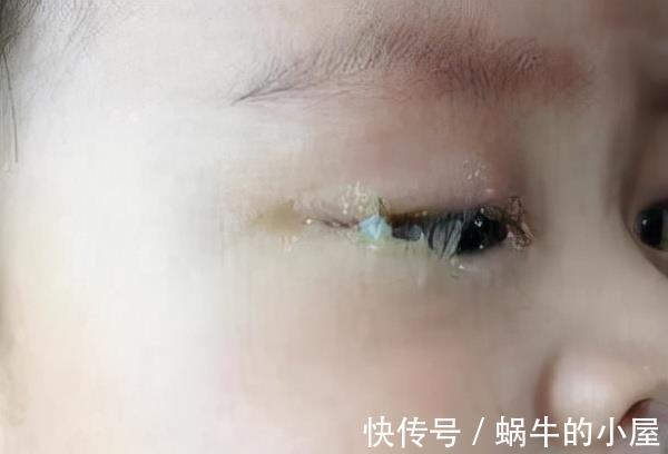 养娃|奶奶用“土方子”给刚出生的娃洗眼睛,养娃还是要按科学的方法来