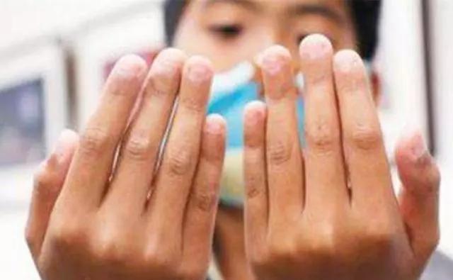 小时候|小时候爱''咬指甲''的孩子,长大后多半是这2种性格,太心疼孩子了