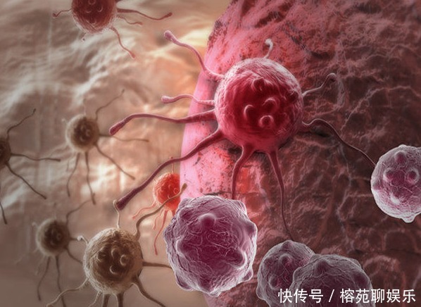 癌症来降临前,多伴有4种信号,教你3招,提前预防癌症,望周知