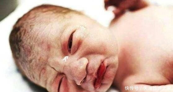 剖腹产|宝宝出生时,有的睁开眼,有的闭上眼,哪种比较好医生说都好