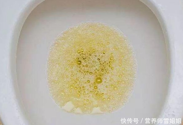 男子|41岁男子,突发肾衰竭,晨起排尿有4种迹象,最好检查一下