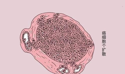 赵老|得了癌症,十年没有复发,他们有哪些抗癌经验?医生:你也能做到