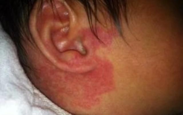 诱人|孕妈在孕期,尽量不做4件事,避免宝宝脸上长胎记,孕妈别不在意