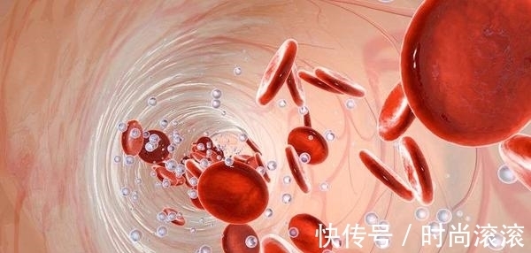 血管|高血脂危害大!40岁后,保护血管,平日少吃4物,别给血管填麻烦