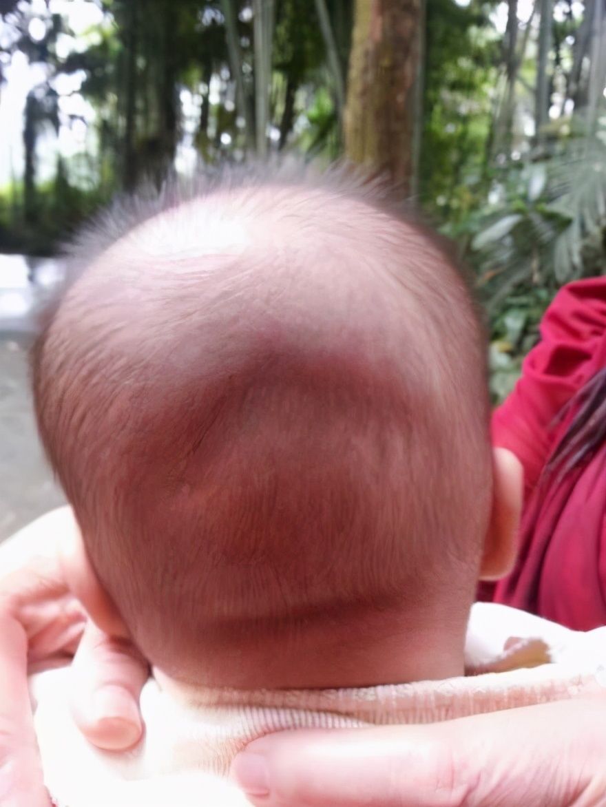 宝宝|宝宝“小脑袋瓜”不能随便摸,会影响孩子智力?囟门真那么脆弱?