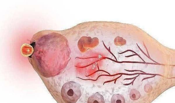 女性|女性一生能生育多少次产科医生给出了答案，可能和你想的不同