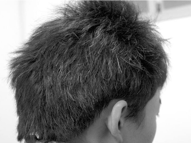 黑色素|民间第一黑发小秒方，让白发变黑发，远离染发烦恼，长出健康发色