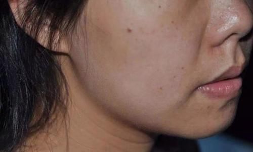 建议皮肤暗黄的女生常“湿敷”,坚持1个冬天,皮肤白1个度不止