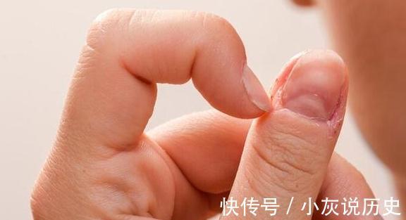信号|抠手,啃指甲停不下来的背后,可能隐藏着一些心理信号