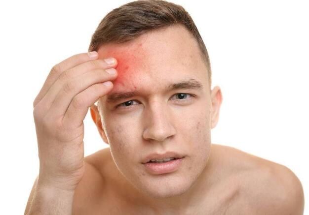 脸上的这四种变化，通常都代表着肺部不好，趁