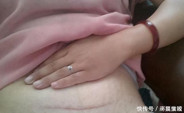 宝妈|头胎选择剖腹产,二胎可以顺产吗?若孕妈是这三种情况,就别想了