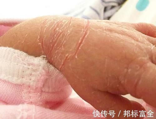 口腔|“黑脸宝宝”走红,长开后变成小帅哥,网友:还好父母忍住没扔