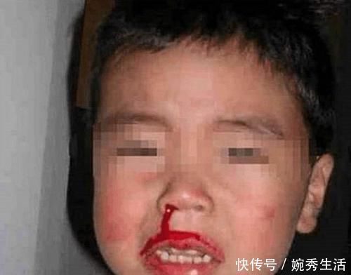 小常识|4岁男孩鼻血不止,送医院被告知“无法抢救”,只因宝妈这一举动