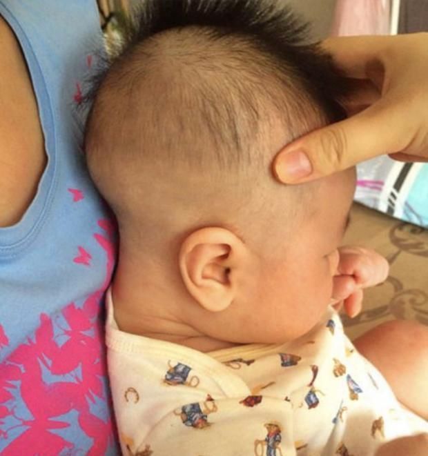 睡眠时间|“脑勺高,聪明包”,宝宝的头型与智商有关?父母们别再被误导了