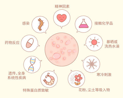 宝宝春季易过敏？这些预防要注意！|妈妈须知| a461