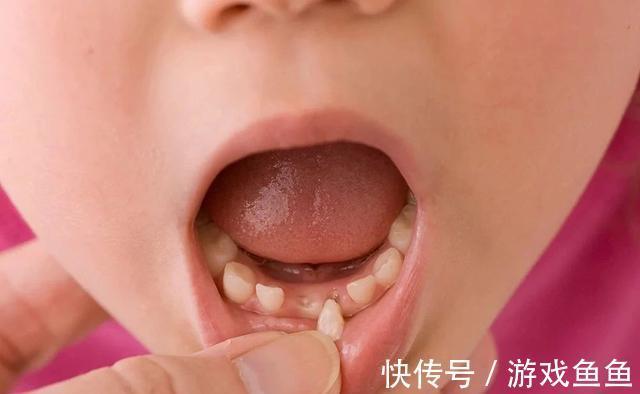 孩子|孩子这颗牙有大“作用”,父母别再乱丢了,关键时刻能救娃一命