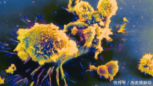  免疫系统|癌症复发是运气不好？5个原因才是导火索，赶紧对照下