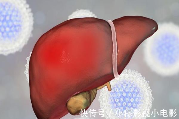 脚底|肝受损,身体知?身体若出现这5“异常”,建议尽快检查