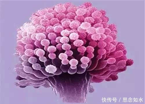 医生|一家四口全患癌!医生曝光的原因为所有人敲响警钟!